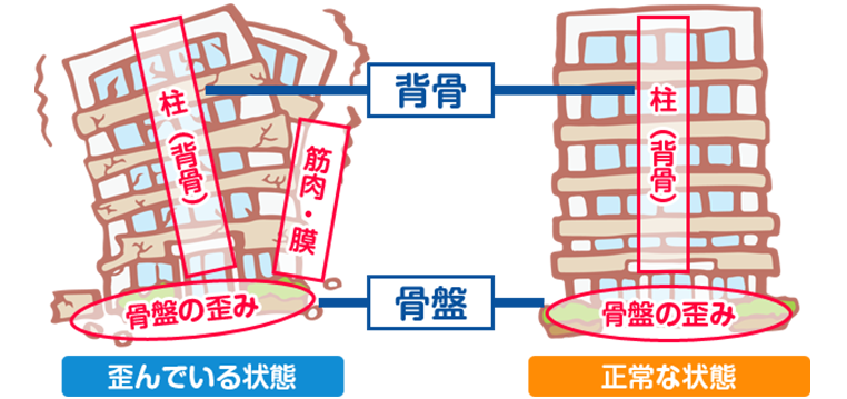 歪みの状態